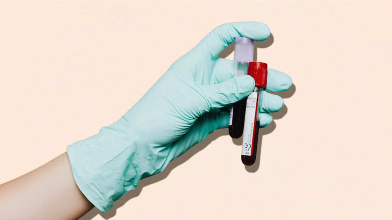 Anti-Müller-Hormon (AMH): Was Dein Wert über Deine Fruchtbarkeit verrät