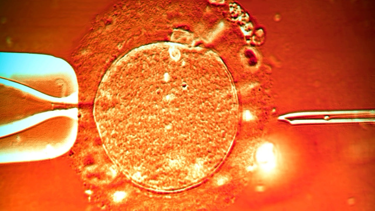 IVF & Kinderwunsch: Ablauf, Kosten & Erfolgsquoten